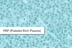 Platelet-Rich Plasma Sydney